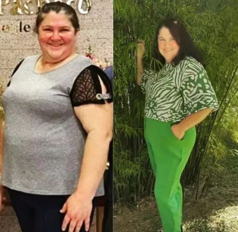 Resultado real de paciente — antes e depois