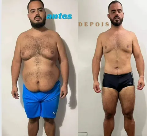 Resultado real de paciente — antes e depois